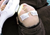 CLEAR/SP-efで顔を照射している写真