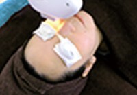 CLEAR/SP-efで顔を照射している写真